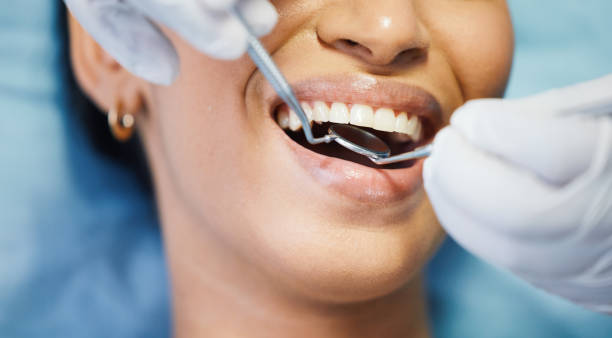 Best Emergency Dentist for Lost Fillings or Crowns in Mokuleia, HI